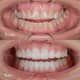 Slider image (9) WinSmile Dental Clinic Vietnam
